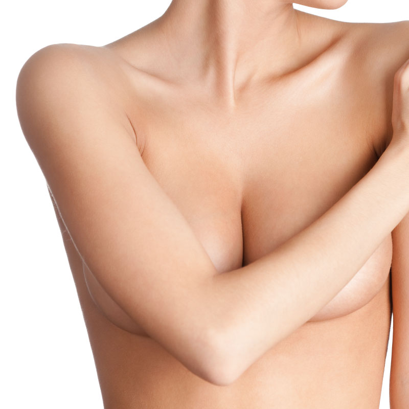 Mamoplastia de aumento