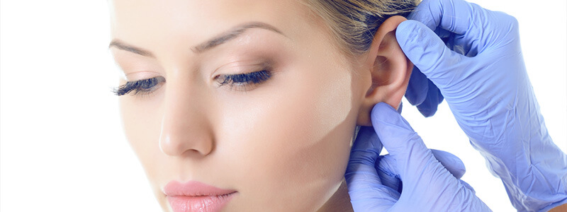 Como é a otoplastia: a cirurgia plástica para orelhas