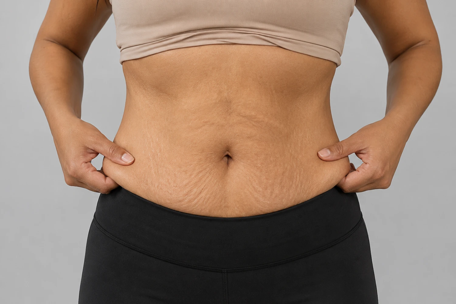 Cirurgia plástica pós-emagrecimento: tudo o que você precisa saber antes do procedimento