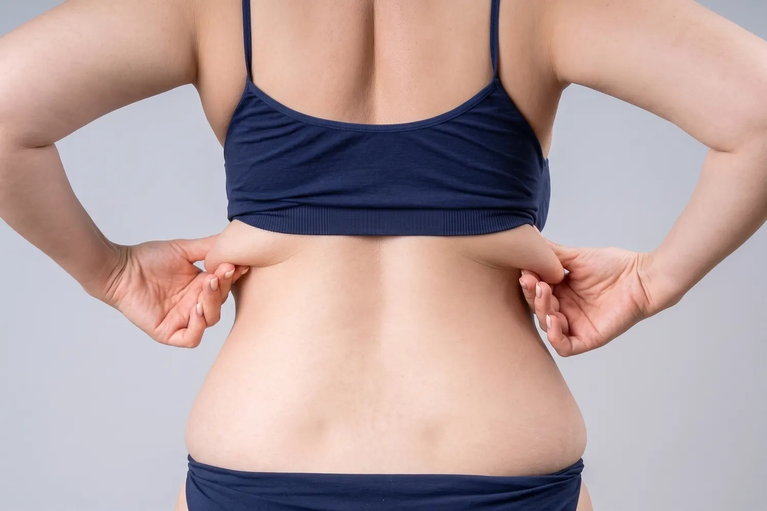 Torsoplastia: como funciona a cirurgia de retirada de excesso de pele das costas